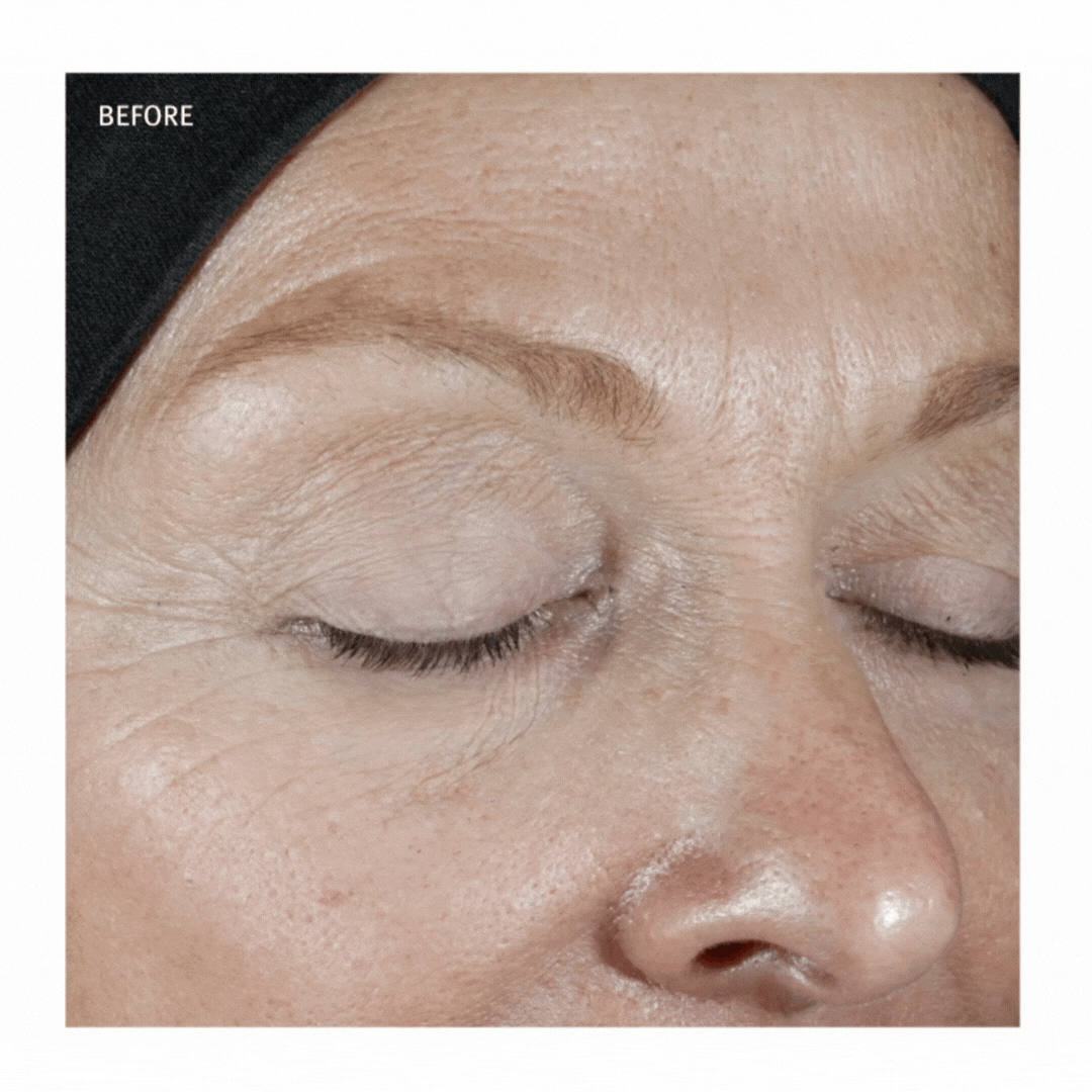 Epionce® in Grapevine, TX