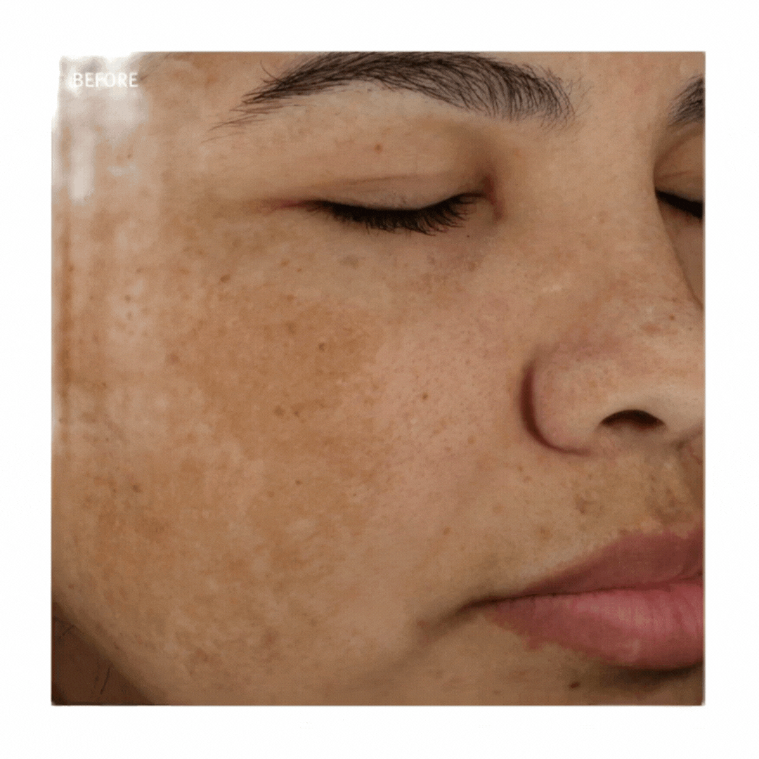 Epionce® in Grapevine, TX