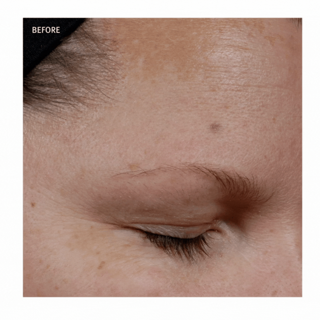 Epionce® in Grapevine, TX