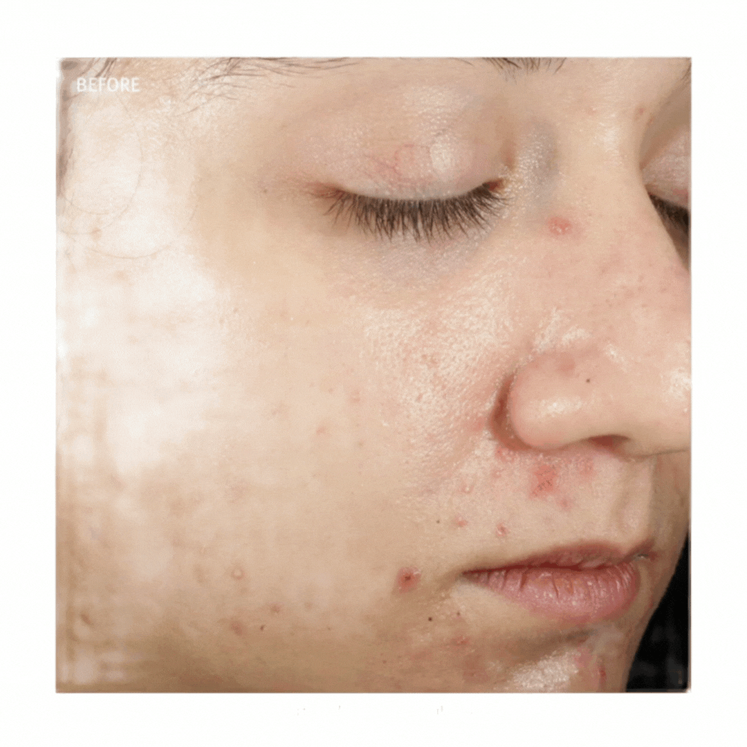 Epionce® in Grapevine, TX