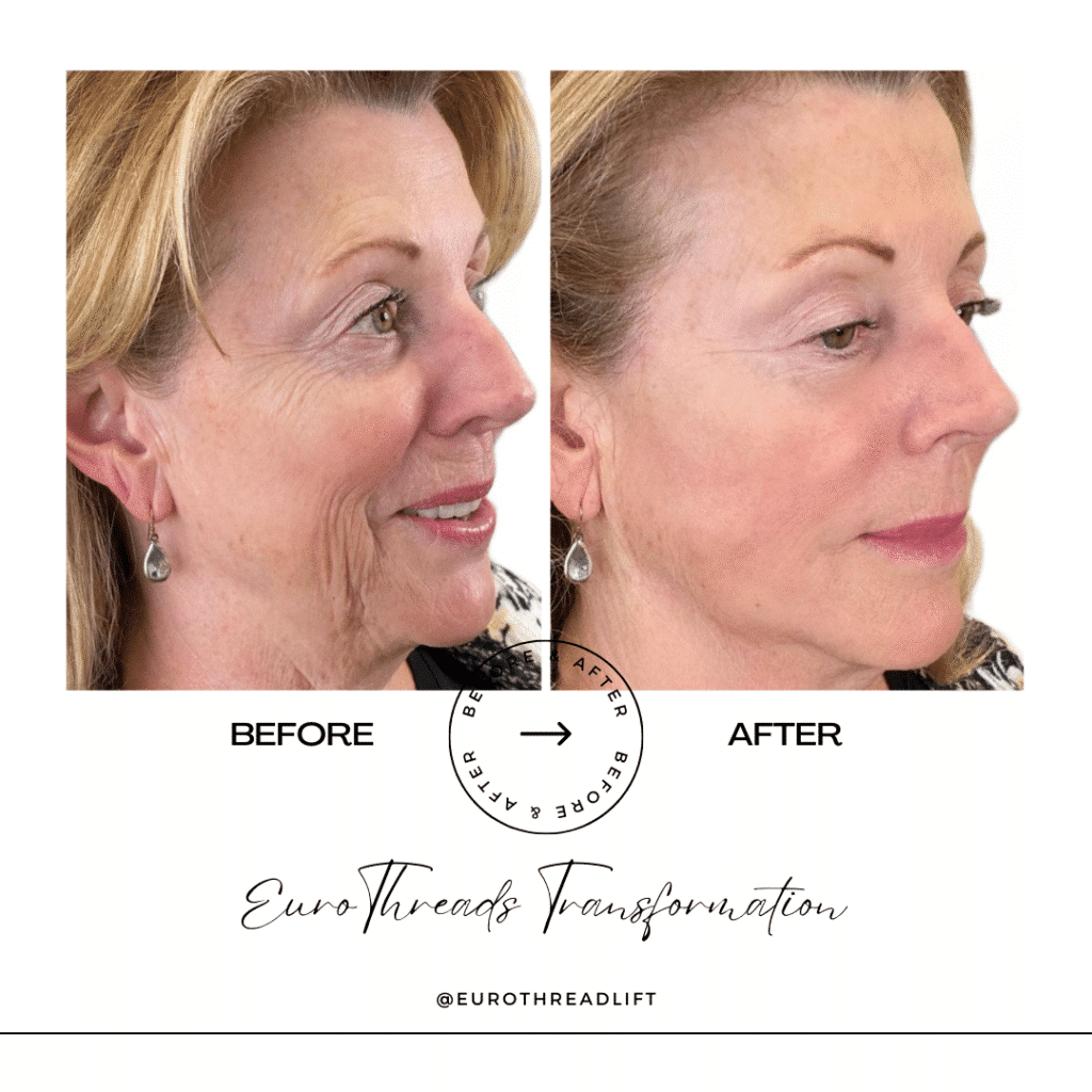 1770844513_6377f3e0bbf44c0c930cd40b7e102c98-1-1 PDO Threads in Grapevine, TX