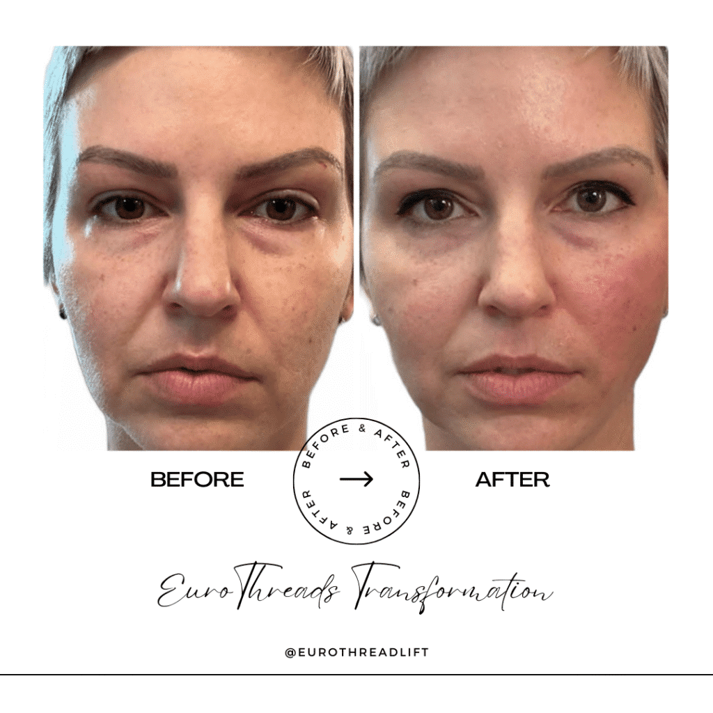 1770844517_d6688199e218449a9c00d1f9b433b481-1-1 PDO Threads in Grapevine, TX