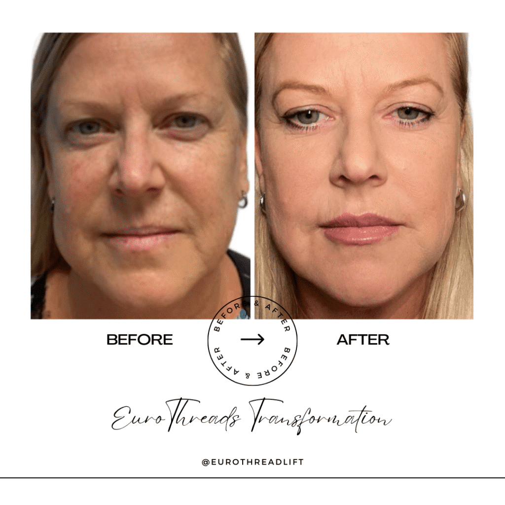 1770844522_91f3aba38fa041d89a3b432e28324c46-1-1 PDO Threads in Grapevine, TX