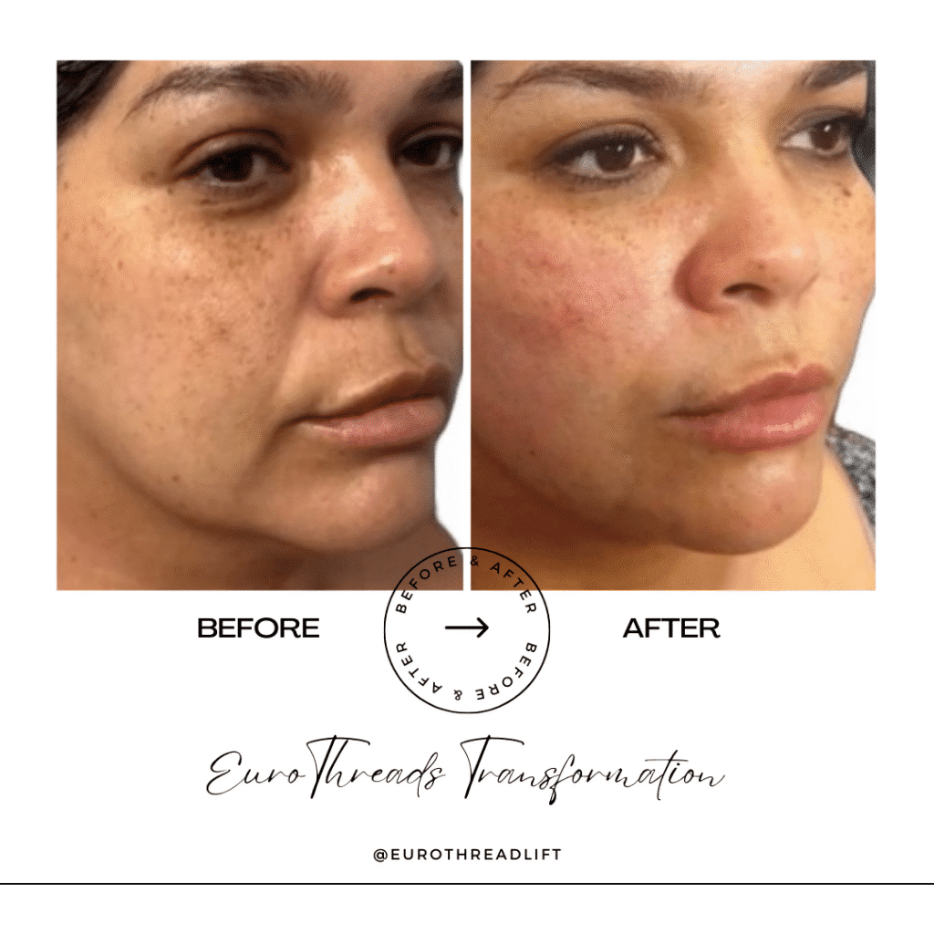 1770844526_3f19296ae0b74b1d8dace6a64aec5cad-1-1 PDO Threads in Grapevine, TX