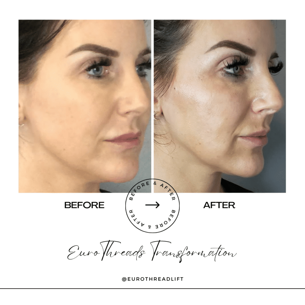 1770844531_4c28e376118e4f1783083958b58d043f-1-1 PDO Threads in Grapevine, TX