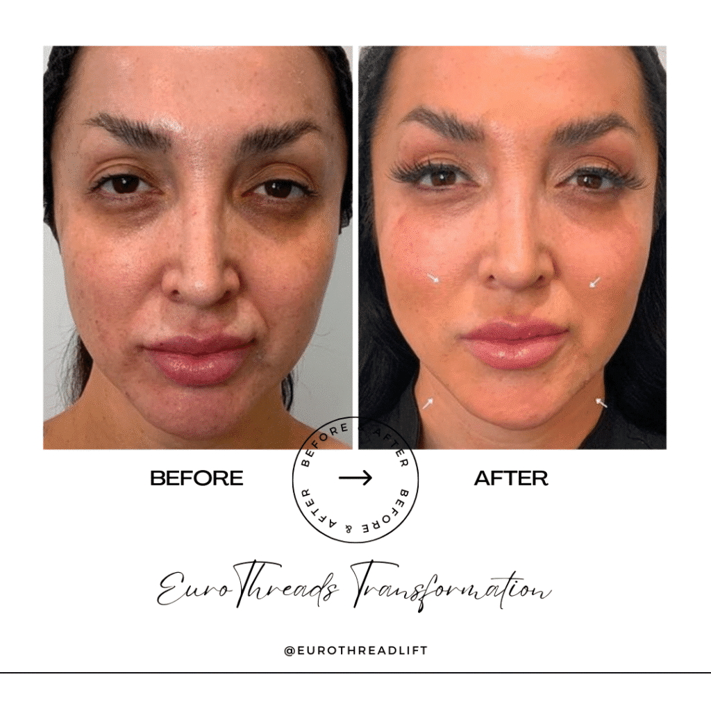 1770844536_cf8d9741a7c64da182e3ec799b760001-1-1 PDO Threads in Grapevine, TX