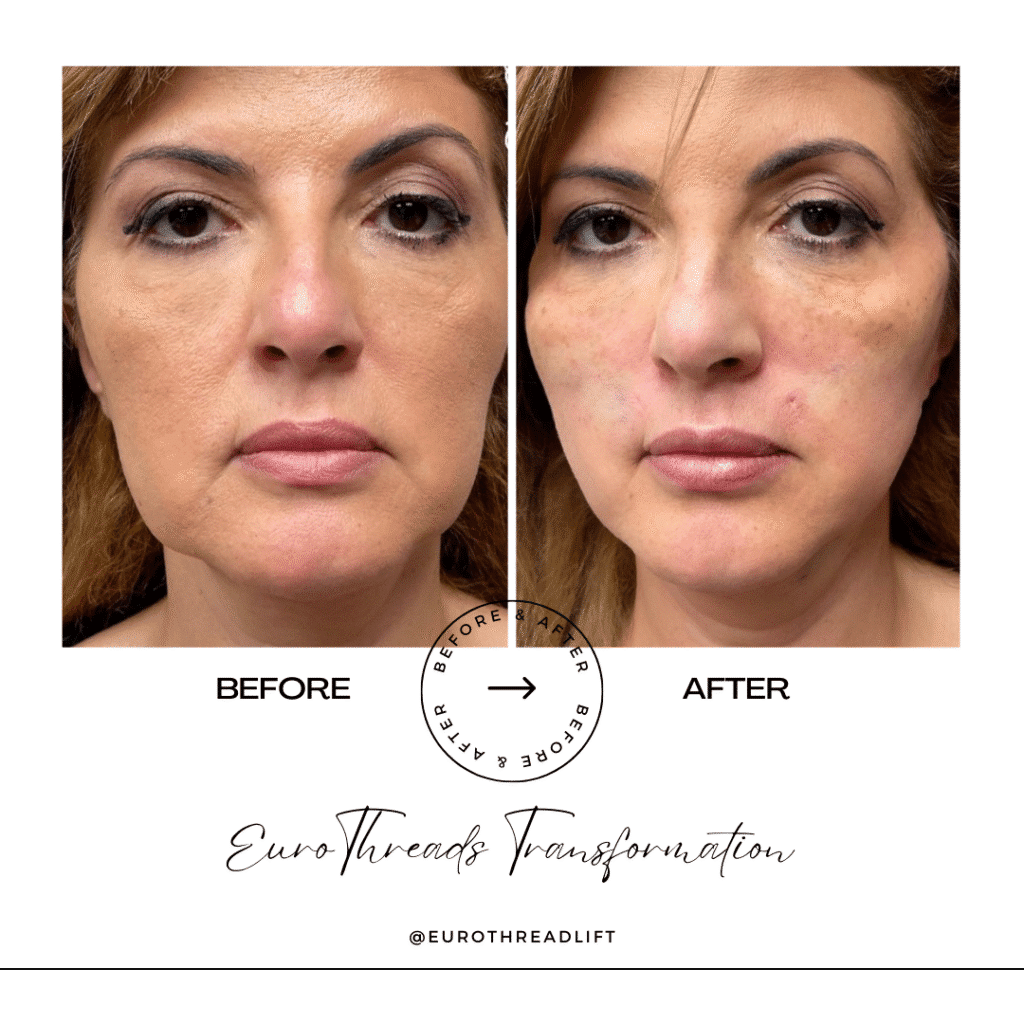 1770844548_a49dc31fd6144b69950fee0e7f50a816-1-1 PDO Threads in Grapevine, TX