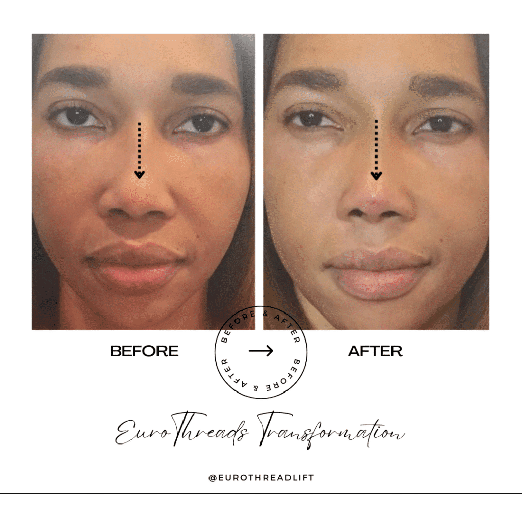 1770844552_43d7c5876b8a4aa2b65308fed28ee0c4-1-1 PDO Threads in Grapevine, TX