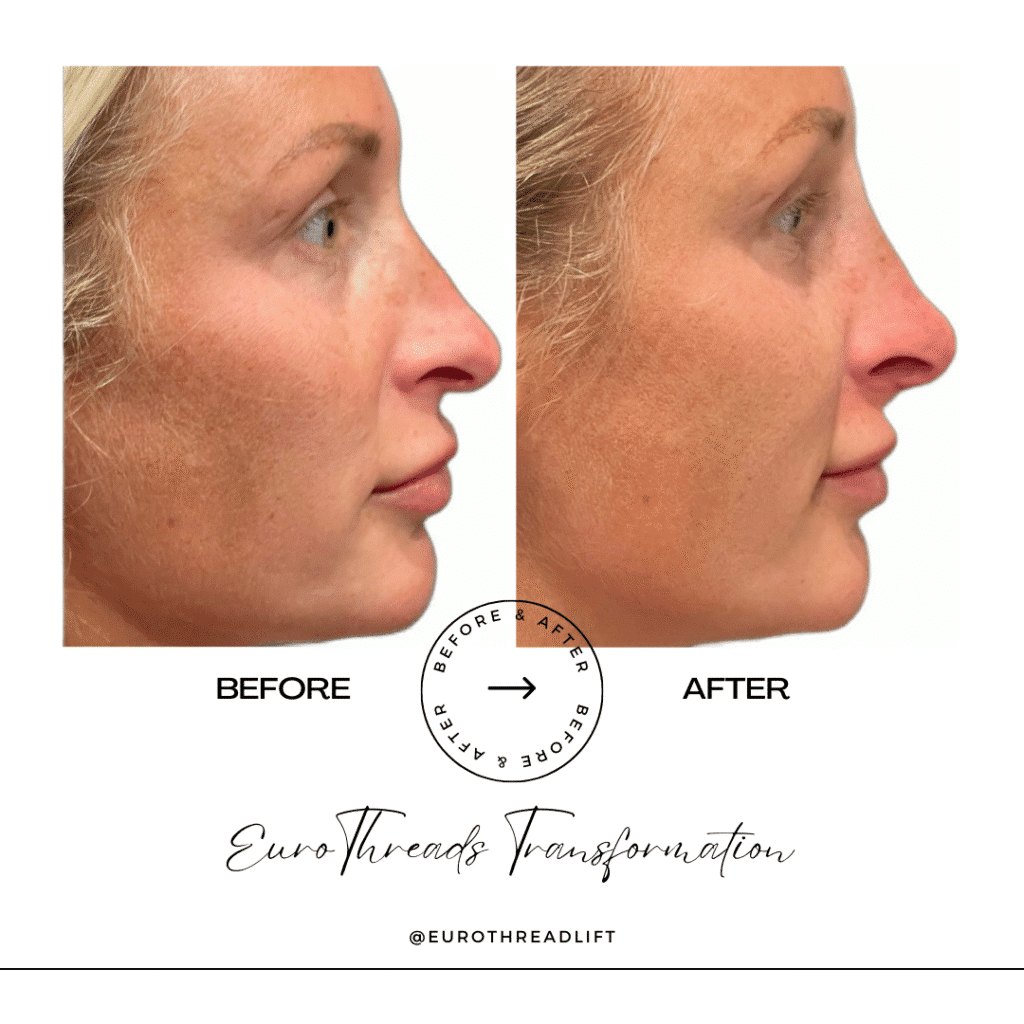 1770844557_d86fde518583489c910da04f7beeecb2-1-1 PDO Threads in Grapevine, TX