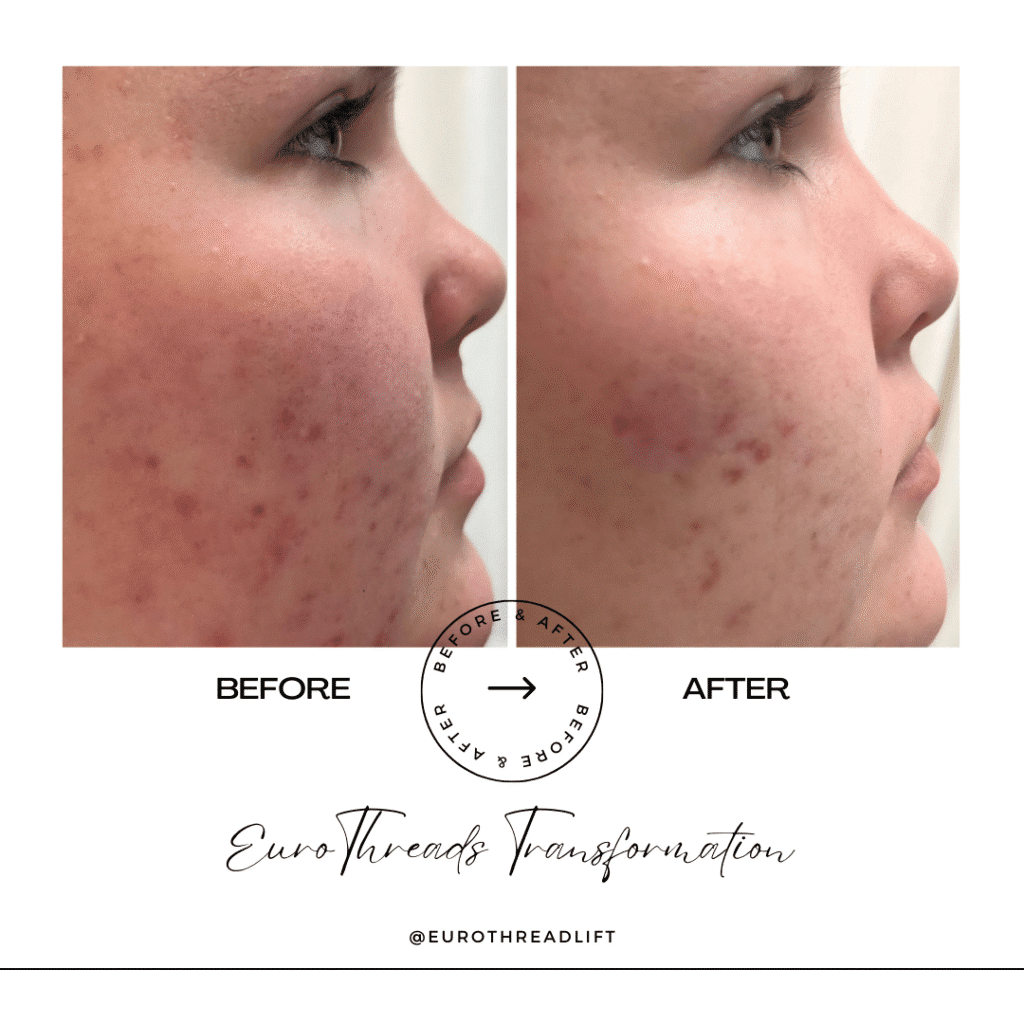 1770844566_92fcba0e702d4e898eed1eb6cdb59e20-1-1 PDO Threads in Grapevine, TX