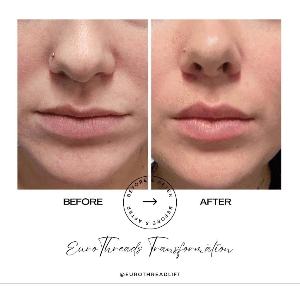 1770844575_5e94b27df9a24b2c85ae3a44bc55e757-1-1 PDO Threads in Grapevine, TX