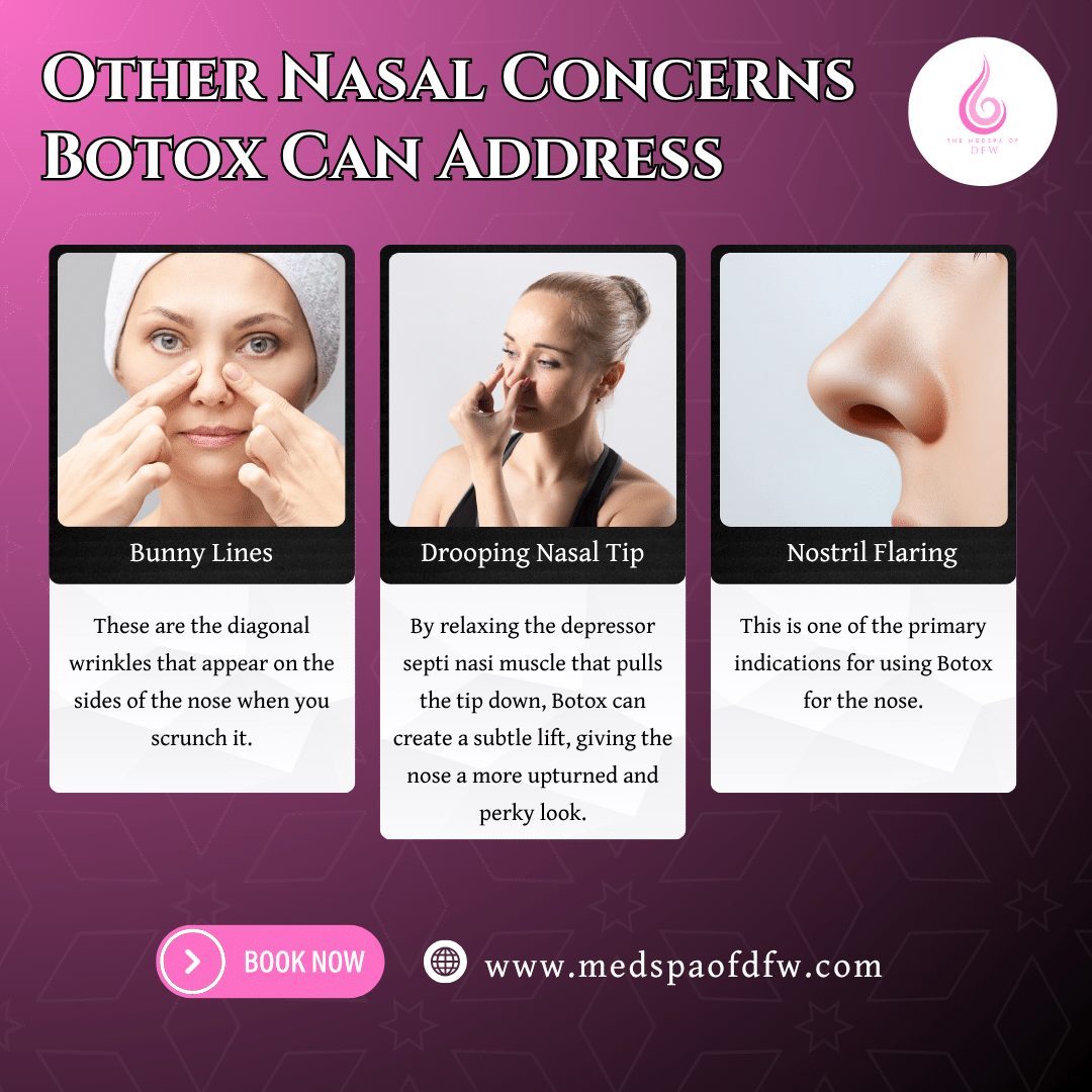 Other Nasal Concerns Botox Can Address