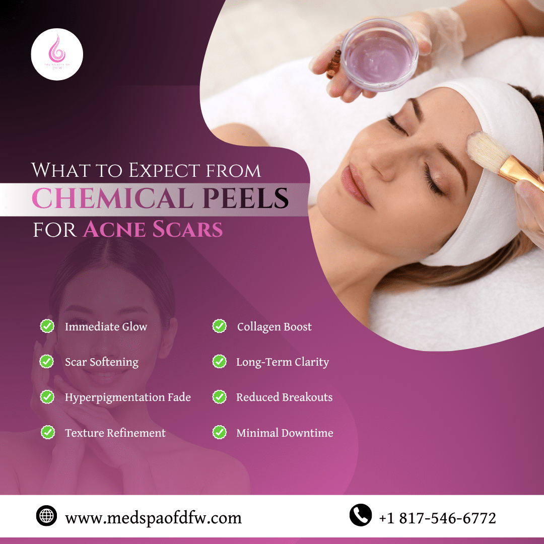 Chemical Peels Before and After: What to Expect from Chemical Peels for Acne Scars