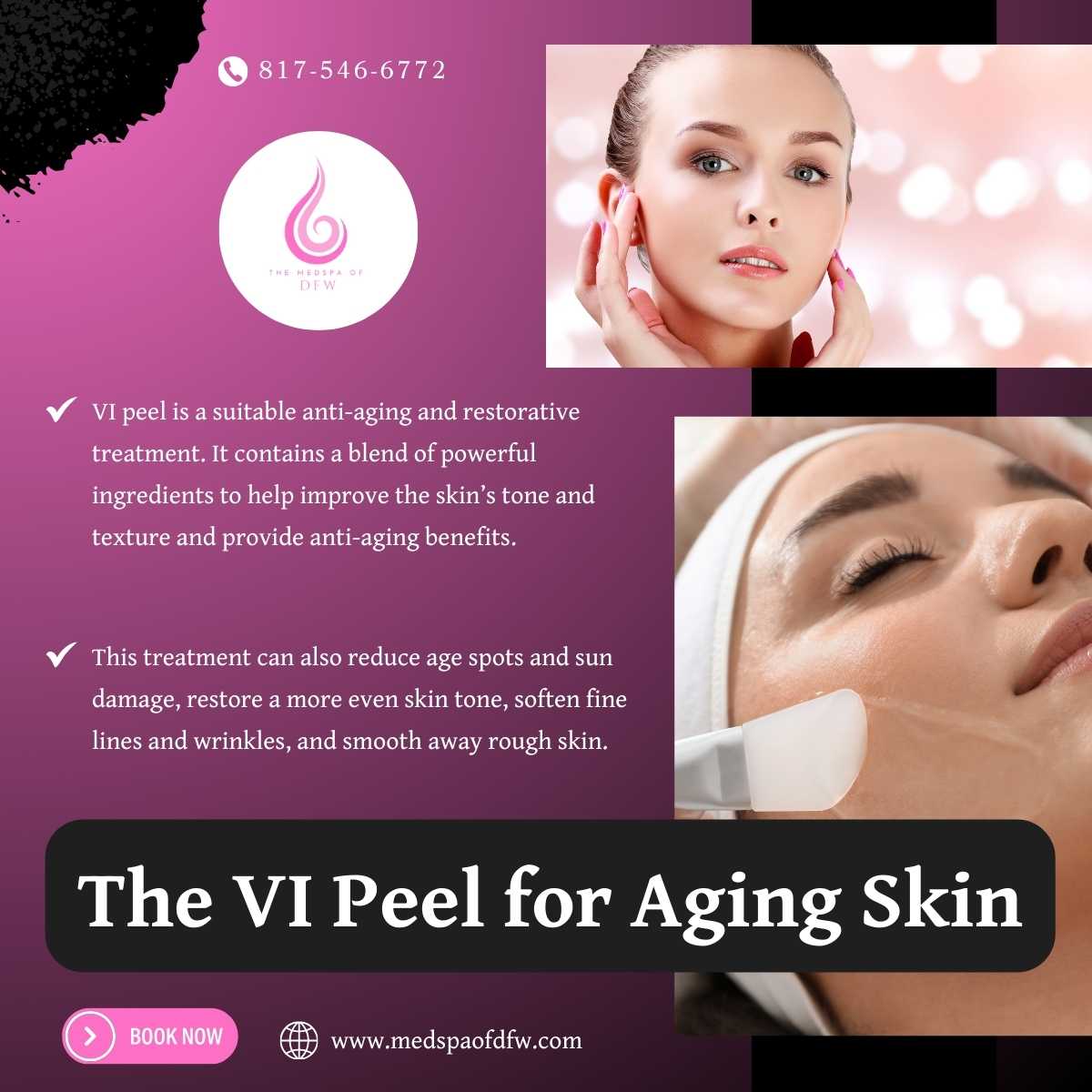 The VI Peel for Aging Skin in Grapevine/Southlake, TX