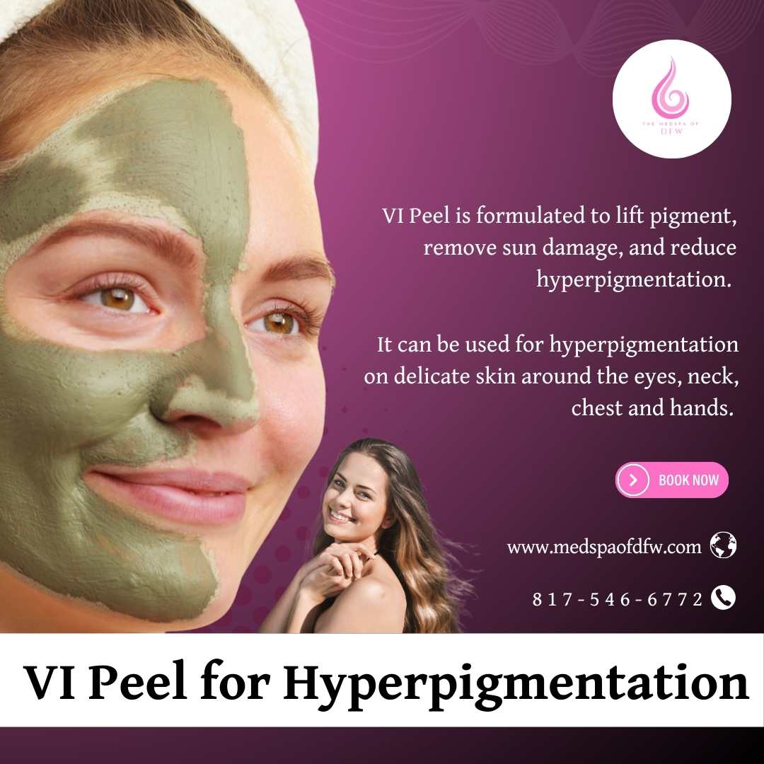 VI Peels for Hyperpigmentation in Grapevine/Southlake, TX
