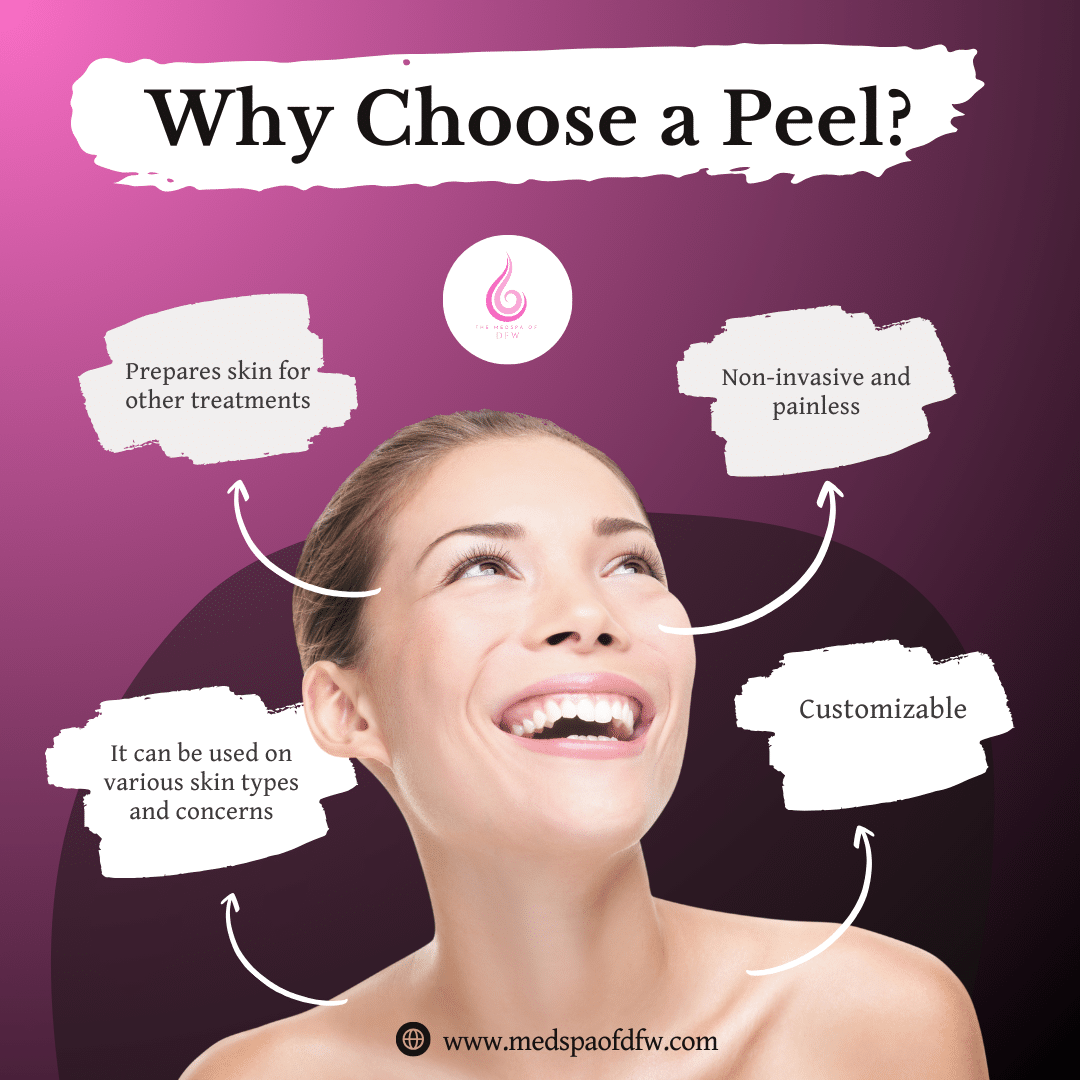 Why Choose a Peel?