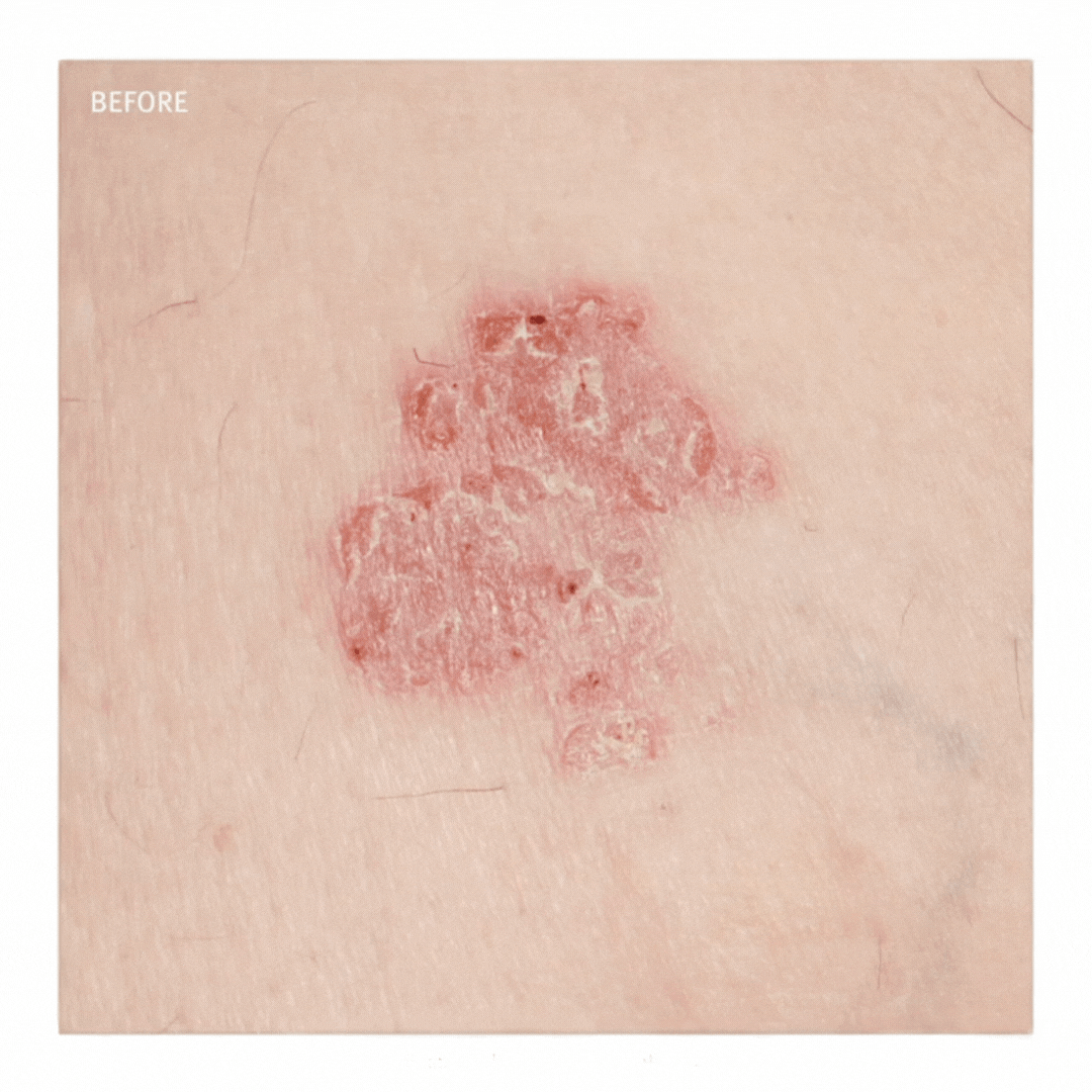 Epionce® in Grapevine, TX