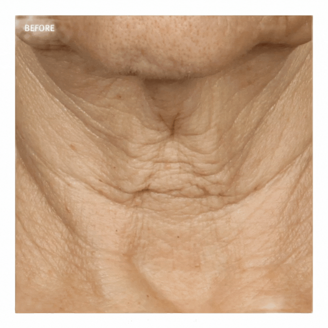 Epionce® in Grapevine, TX