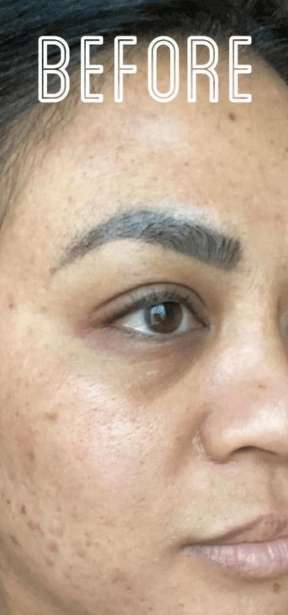 Before Image: VI Peel - right-front-oblique