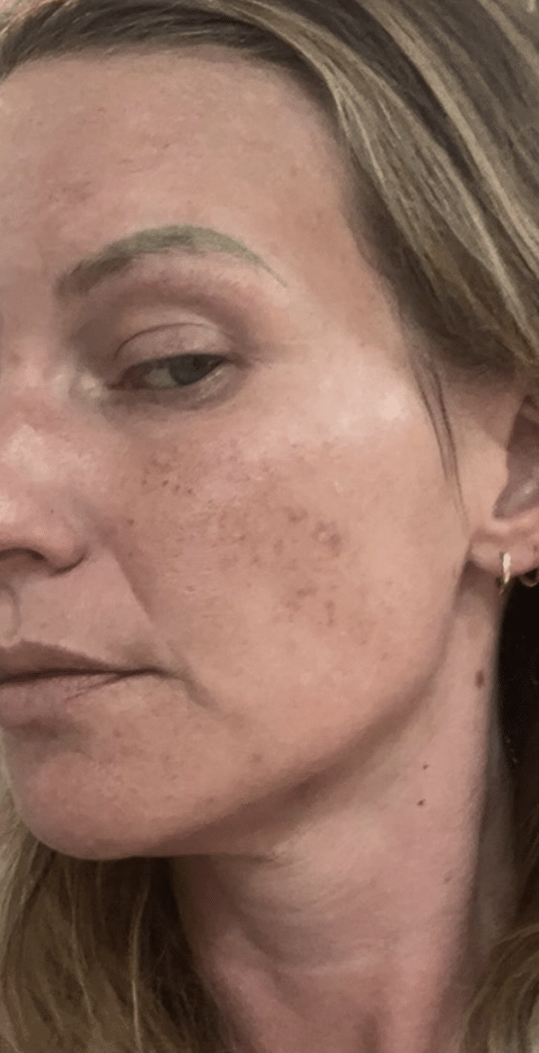 After Image: Nouvaderm - left-front-oblique