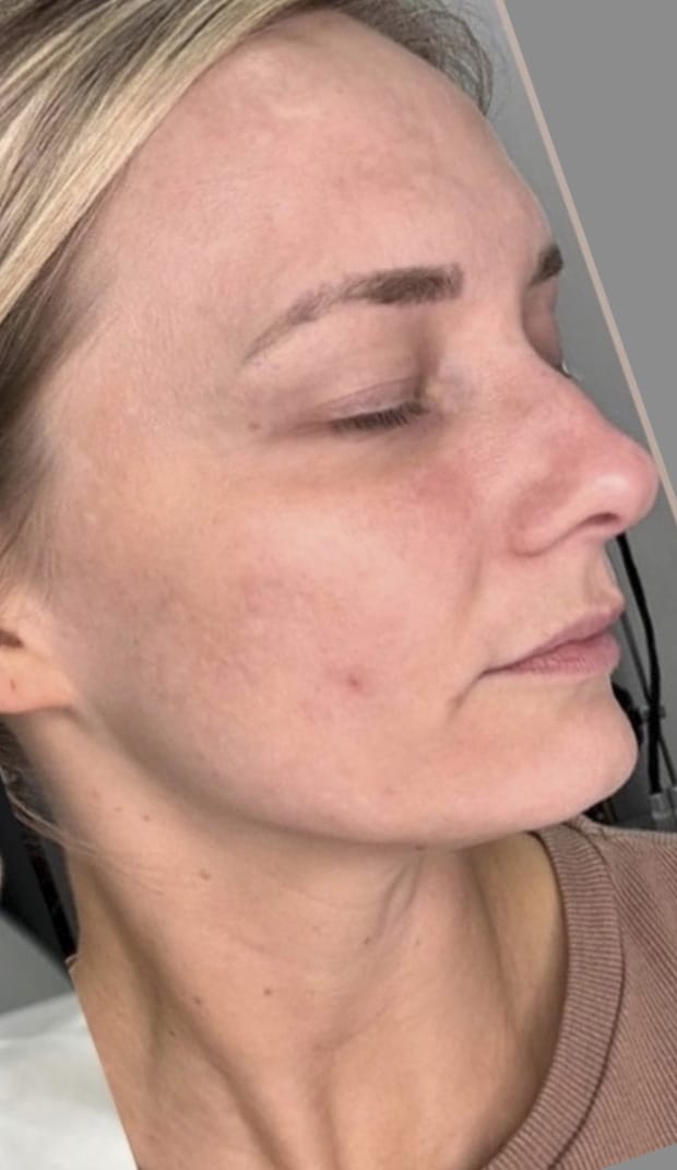 After Image: Nouvaderm - right-front-oblique