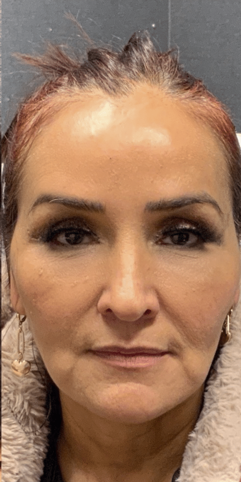 After Image: Neurotoxin - front