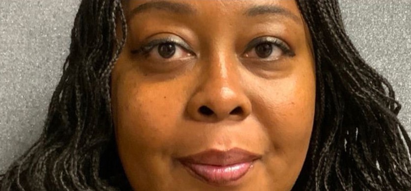 Before Image: Restylane - front