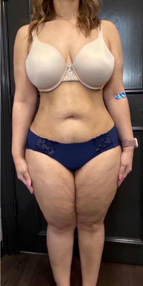 After Image: Weight Loss - front