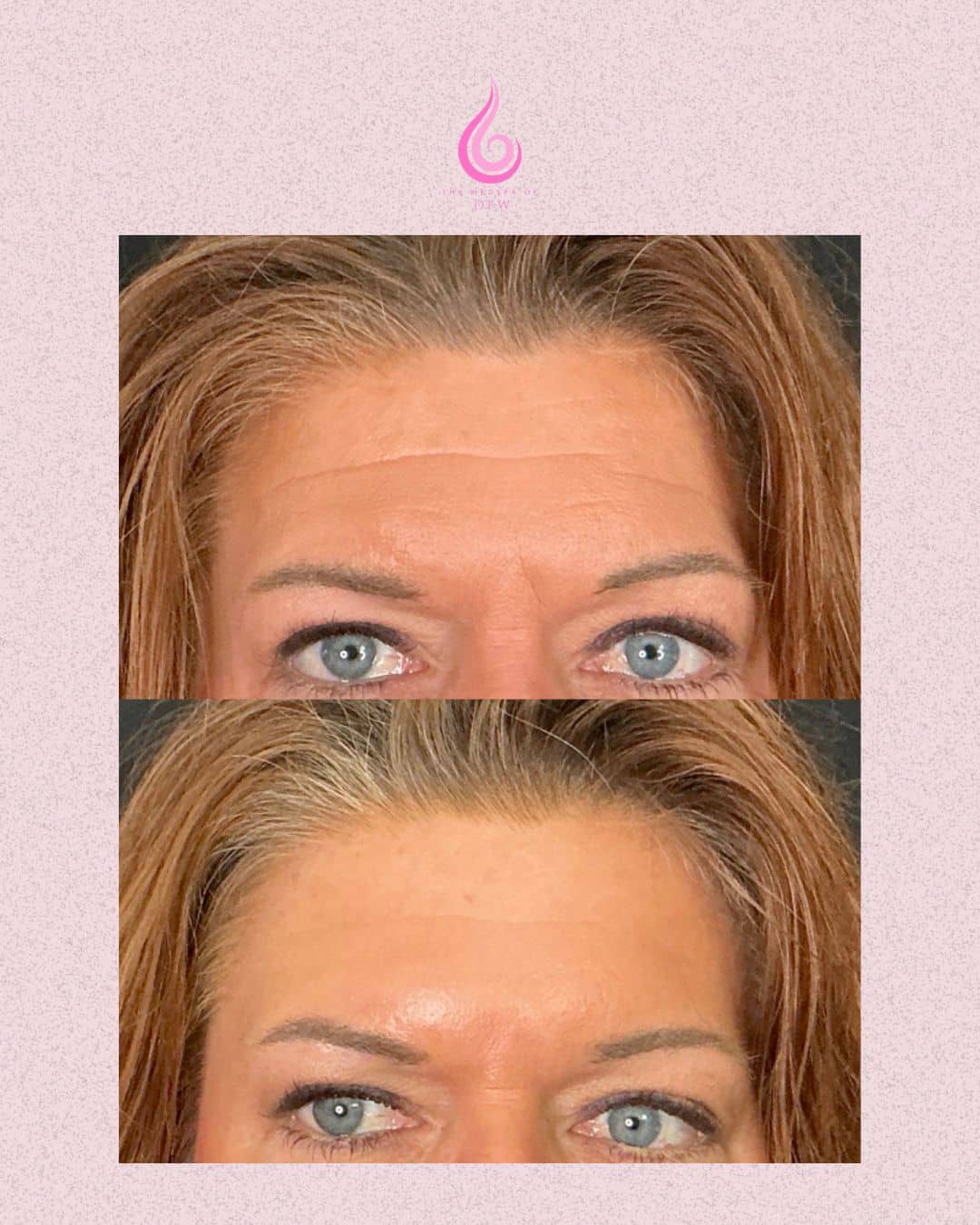 Before and After Image: Tox - front